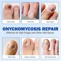 Set van 84 pleisters voor de dagelijkse voetnagelverzorging voor beschadigde teennagels en teennagels, 8 uur nachtverzorging met natuurlijke ingrediënten om de nagels te verzorgen — thumbnail 3